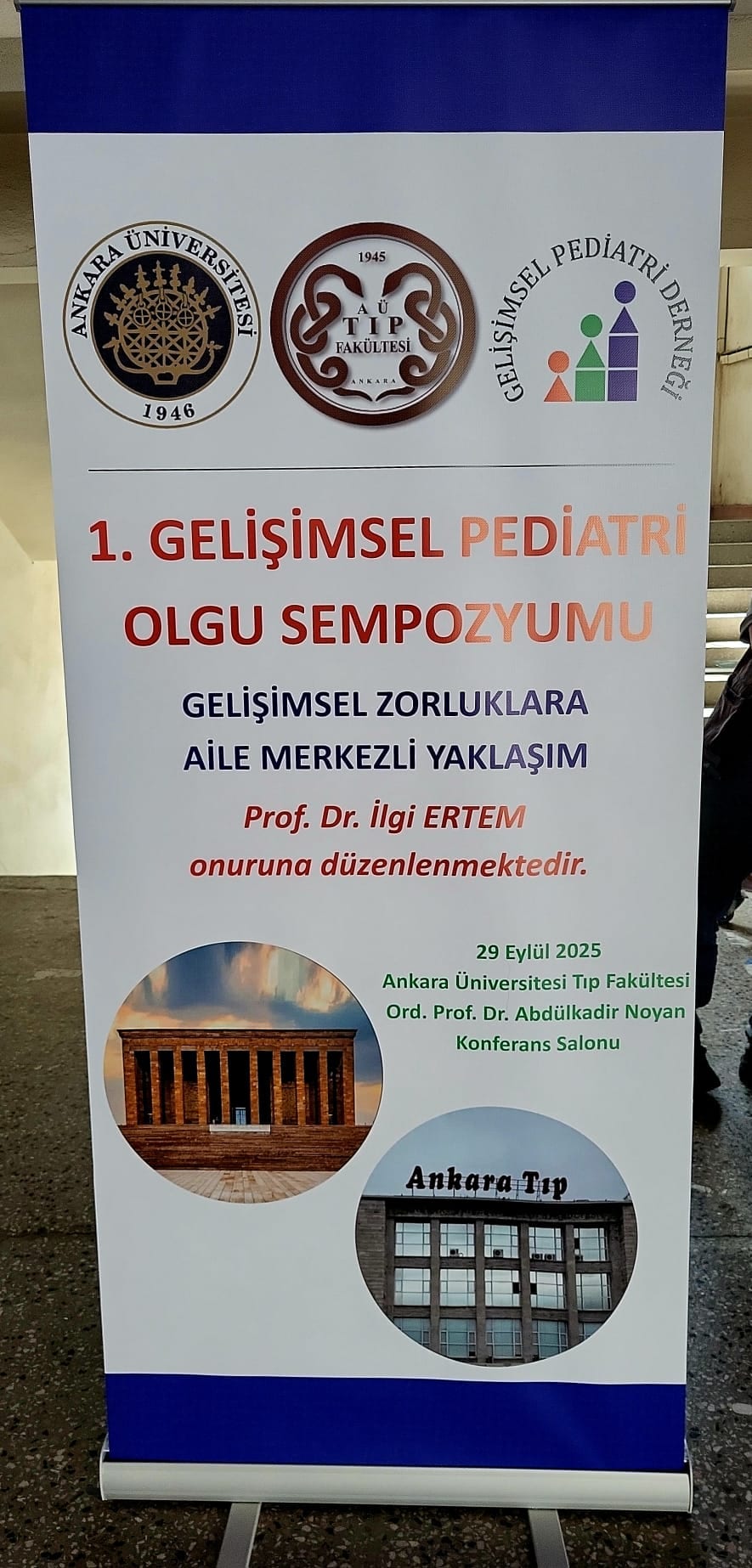 Ankara Roll Up Stand - Ankara Reklamcı Görsel 10